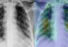 Pakistan Develops AI Based Software To Detect COVID-19 In Under 60 Seconds Pakistan Develops AI Based Software To Detect COVID-19 In Under 60 Seconds