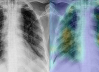 Pakistan Develops AI Based Software To Detect COVID-19 In Under 60 Seconds Pakistan Develops AI Based Software To Detect COVID-19 In Under 60 Seconds